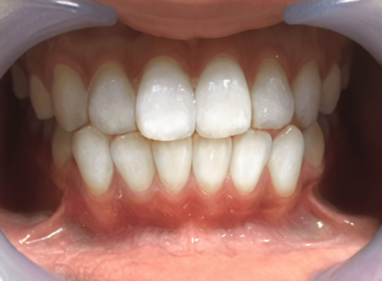 実例1 after